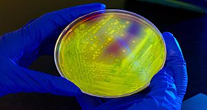 A close up photo of gloved hands holding a petri dish of C. diff culture