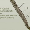 The tail region of a female amaryllis lesion nematode.