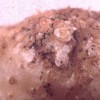 Root-knot nematode (Meloidogyne spp.) induced galls on a potato.