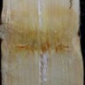 Reddish discoloration of vascular bundles at the sugarcane node due to the causal agent of ratoon stunting.
