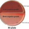 Bi-plate of Minnesota Easy Culture System II. (Top: Factor agar. Bottom: MacConkey agar.)
