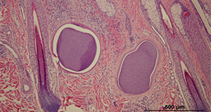 Microscopic image of two Besnoitia cysts within a skin biopsy obtained from a donkey with besnoitiosis. H&E 100x.