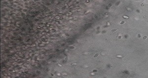 Spironucleus organisms seen under 400x microscopy.